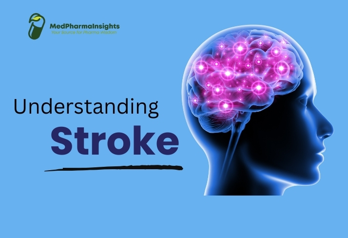 Stroke: Understanding the Causes, Symptoms, and Prevention