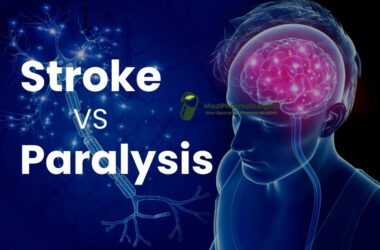 Difference between stroke and paralysis